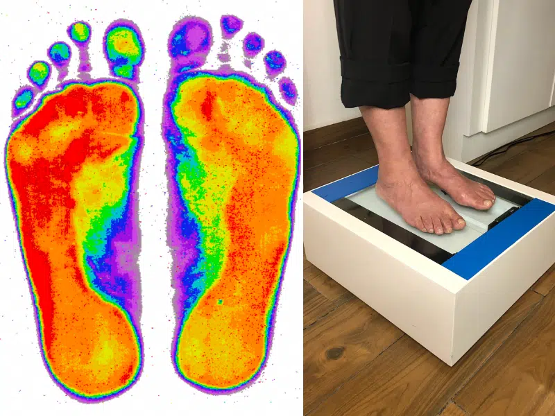 estudio-presion-plantar-baropodometria presion plantar baropodometria quiropractico